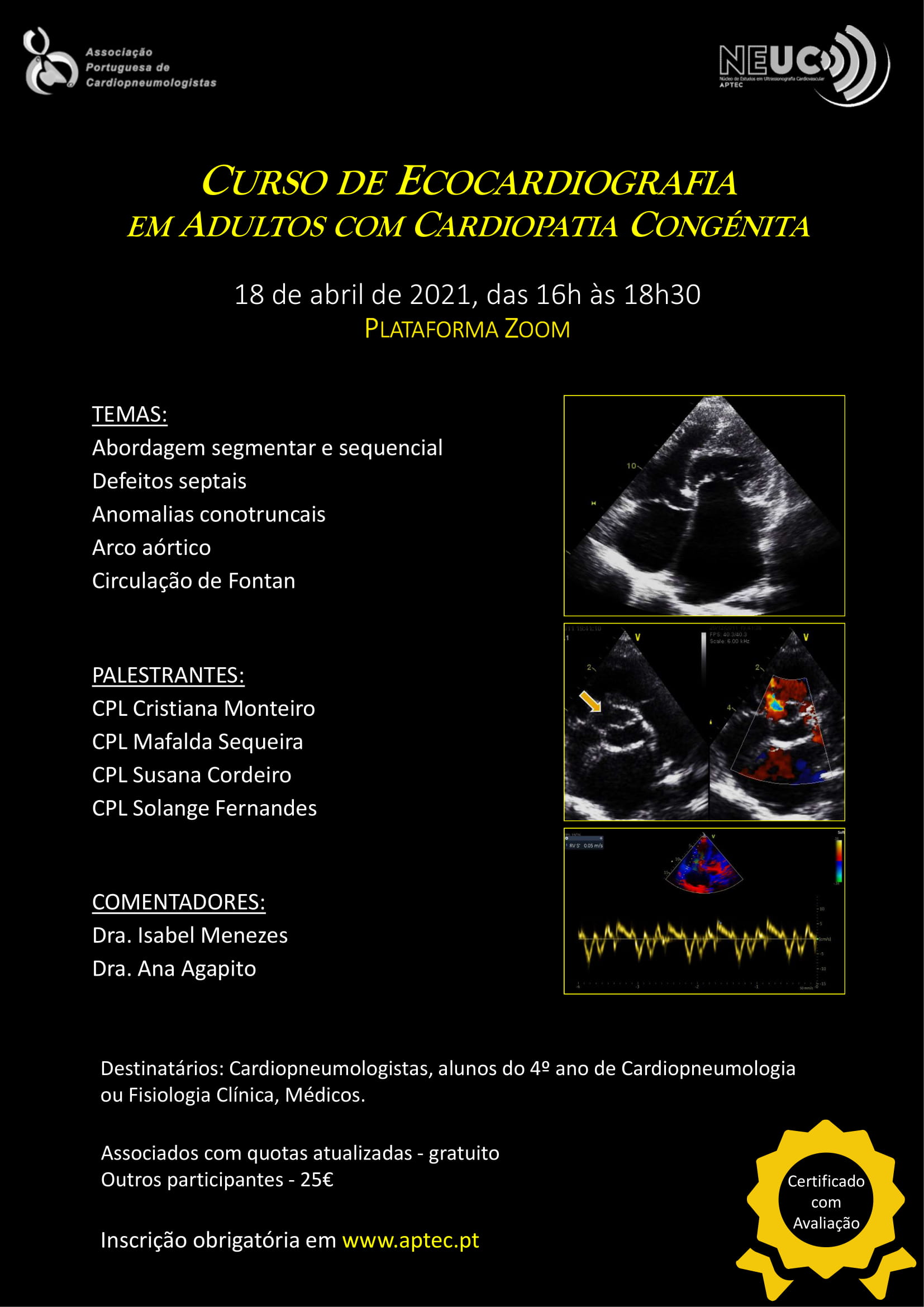Curso de Ecocardiografia em Adultos com Cardiopatia Congénita